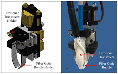 Purdue University researchers are developing a biomedical imaging system that combines optical and ultrasound technology to improve the diagnosis of life-threatening diseases. Image courtesy of Purdue Research Foundation.
