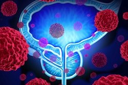 2016 10 04 11 38 34 158 Prostate 400