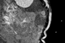 2018 09 04 17 24 0277 Ccta Scan 20180904171459