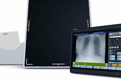 2018 09 12 16 32 2712 Carestream Drx Transportable Lite System 20180912163800