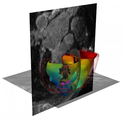 3D virtual heart. Image courtesy of Johns Hopkins University.