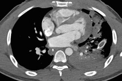 2018 09 14 21 46 6790 Chest Ct Bullet 20180914211624