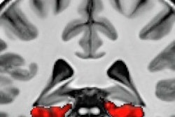 2018 09 18 23 53 0871 7 T Mri B 01 277