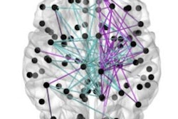 2018 09 21 21 57 1118 Milk Brain Connection 400