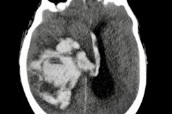 2018 09 24 19 54 6943 2018 09 25 Autopsy Ct Image Thumb Ame