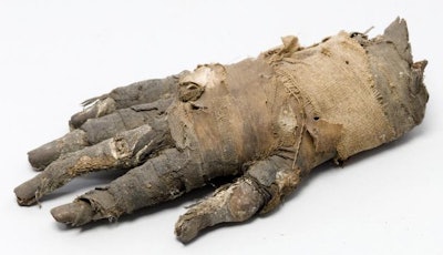 Mummified hand of an Egyptian man from 400 B.C. Image courtesy of Jenny Romell from KTH Royal Institute of Technology.