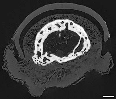 Phase-contrast CT scan of the mummy's middle finger displays vessels, fat tissue, and distinct layers of the skin. The image resolution of this axial section is between 6 µm and 9 µm. The scale bar represents 1 mm. Image courtesy of Jenny Romell.