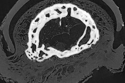 2018 09 24 23 13 9349 Phase Contrast Ct Mummy 20180924234530