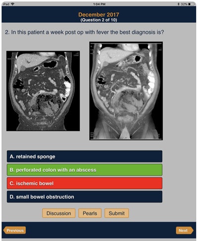 CTisus iQuiz: The HD Edition. Image courtesy of Dr. Elliot Fishman.