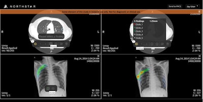 Several EnvoyAI platform results from AI companies on the EnvoyAI Exchange are shown within TeraRecon's Northstar AI Results Explorer. Image courtesy of TeraRecon.