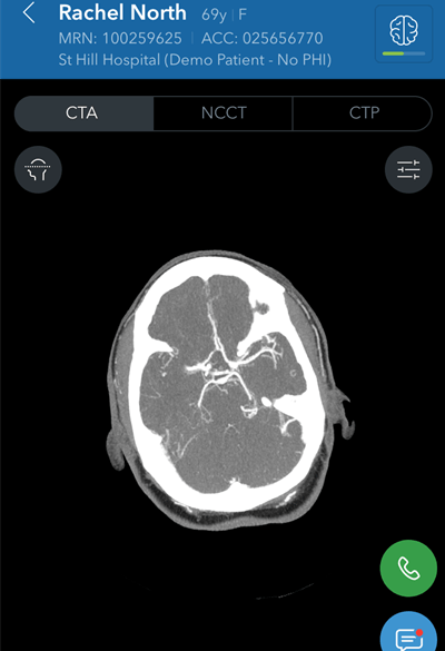 Image courtesy of Viz.ai.