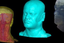 2018 09 28 20 20 5561 3 D Printed Head Phantom 20180928200953