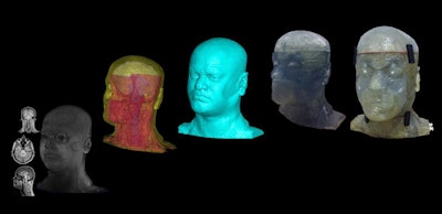 A 3T MRI dataset (left), segmented 3D model (middle), and 3D-printed phantom head (right). Image courtesy of the University of Pittsburgh Radiofrequency Research Facility.