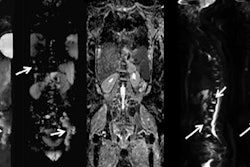 2018 10 22 23 50 6362 Wb Mri Cancer Images Jacobs Ar 20181022232318
