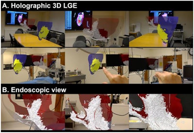 Visualization of 3D pig heart models based on late gadolinium enhancement (LGE) cardiac MRI. Image courtesy of Jang et al.
