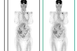 2018 11 05 17 02 2910 Subtle Medical Scan Images 20181105174411