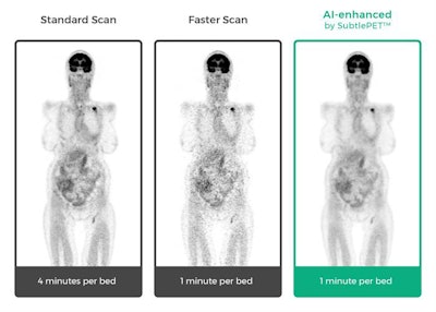 Different scan times and visualizations of PET. Image courtesy of Subtle Medical.