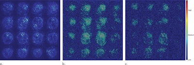 Saliency maps of the deep-learning model on the classification of Alzheimer's disease. (a) A representative saliency map with anatomic overlay in a 77-year-old man. (b) Average saliency map over 10% of dataset from Alzheimer's Disease Neuroimaging Initiative. (c) Average saliency map over independent test set. The closer a pixel color is to the 'high' end of the color bar in the image, the more influence it has on the prediction of Alzheimer's disease class. All images courtesy of Radiology.