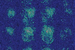 2018 11 06 18 51 0111 Alzheimers Ai Sohn 400b 20181106183822