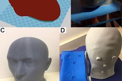 2018 11 07 22 59 6523 3 D Printed Head 20181107221816