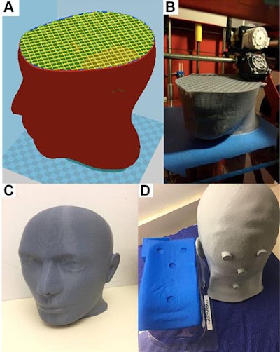 3D-printed head model and matching neck rest. Image courtesy of Wong et al. CC BY-NC 4.0.