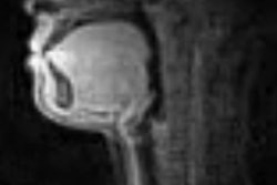 2018 11 08 22 39 4478 Beastbox Mri 400