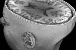 2018 11 12 18 43 2626 Usc 7 T Brain Mr Image Toga 400