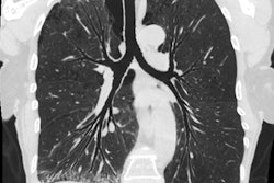 2018 11 14 01 49 3465 Vida Hyperion View 20181114011652