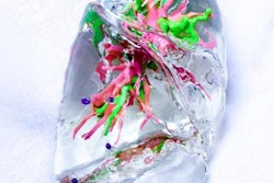 2018 11 14 22 51 1379 3 D Printed Lung 20181114220142