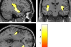 2018 11 14 23 57 7236 Mri Self Injuring Girls 20181115000102