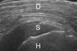 2018 11 15 18 05 4789 Diabetes Us 400