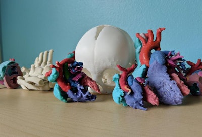 Color-coded 3D-printed heart models. Image courtesy of Justin Ryan, PhD.