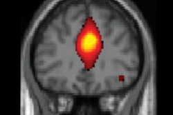 2018 11 20 01 21 9038 Rsna 2018 Murugesan Football 400