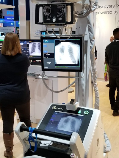 GE is showing Critical Care Suite on the Optima XR240amx mobile x-ray system.