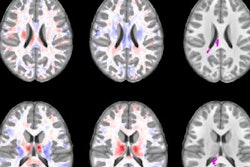 2018 11 28 23 28 2293 Brain Mri Football 20181128234600