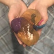 2018 11 29 23 27 9717 3 D Printed Kidney 20181129233359