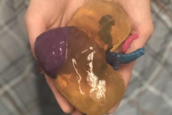 2018 11 29 23 27 9717 3 D Printed Kidney 20181129233359