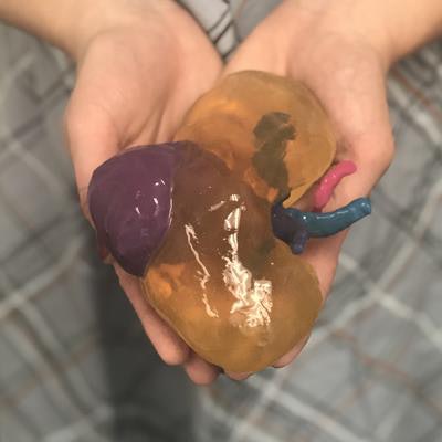 2018 11 29 23 27 9717 3 D Printed Kidney 20181129233359