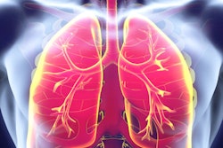 2018 07 26 18 08 5552 Lungs Red 400