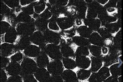 2018 11 30 20 13 0263 2018 12 03 Biopsy Adipocytes Thumb