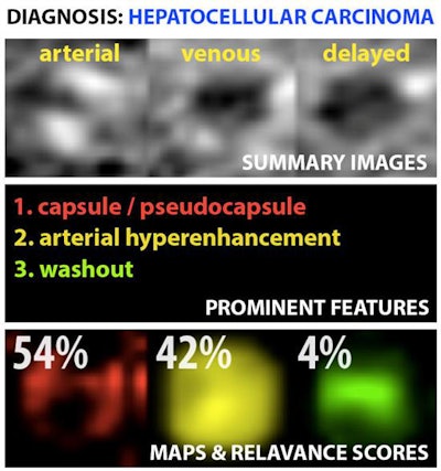 Example output of the Yale group's patent-pending 'explainable' deep-learning system. In addition to providing a prediction (e.g., hepatocellular carcinoma), an explainability algorithm justifies the system's decisions with radiological features, feature maps, and relevance scores that contributed to its analysis. Image courtesy of Dr. Julius Chapiro.