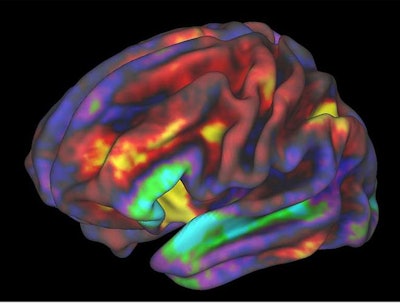 Functional MR brain image of preteen performing a working memory task. The regions in yellow and red are most active. Image courtesy of Richard Watts, PhD, University of Vermont, and Fair Neuroimaging Lab, Oregon Health and Science University.