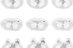 2018 12 05 18 30 8337 Pet Mri Dose Mol 20181205184804
