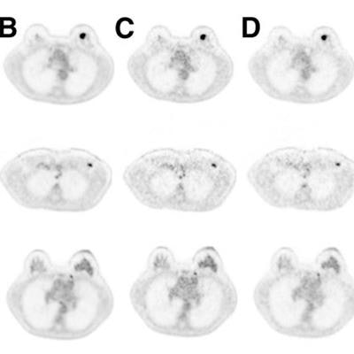 2018 12 05 18 30 8337 Pet Mri Dose Mol 20181205184804