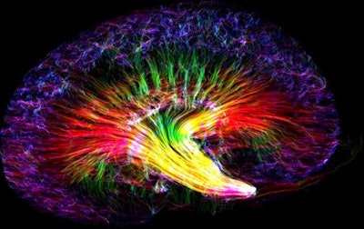 Diffusion-tensor MR image of a kidney at 10-micron isotropic resolution. The image makes it possible to estimate location, orientation, and anisotropy of the tubular tracts; colors represent the different orientation of tubules. Image courtesy of BMC.