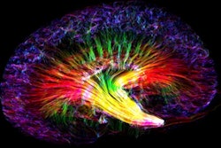 2018 12 14 00 49 3797 2018 12 14 Kidney Rainbow 400