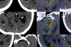 2018 12 14 23 21 4178 Ai Ich 20181214235631