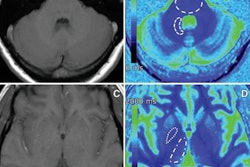 2019 01 04 21 50 3293 Gbca T1 Maps Saake Rad 20190104212426