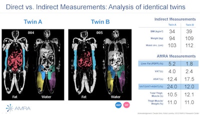 AMRA Profiler software shows different measurements derived from body fat analysis of identical twins.