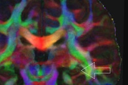 2019 01 09 00 52 5496 Muse Mri Chen 400